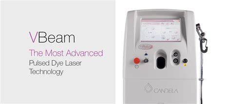 Vbeam Laser Treatment Us Dermatology Partners