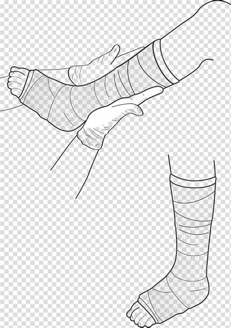 Leg In Cast Clipart 10 Free Cliparts Download Images On Clipground 2024