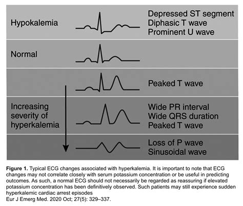 Hyperkalemia Revisited Recapem The Best Porn Website