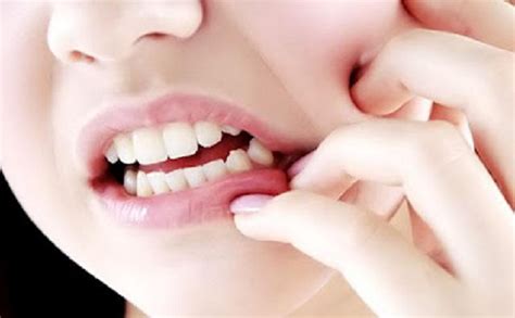 Menghilangkan rasa sakit dengan obat sakit gigi alami seperti garam, daun sirih, cengkeh sakit gigi memang membuat orang merasa kurang nyaman. Gigi Berlubang Tidak Sakit, Perlukah Dicabut? - dakwatuna.com