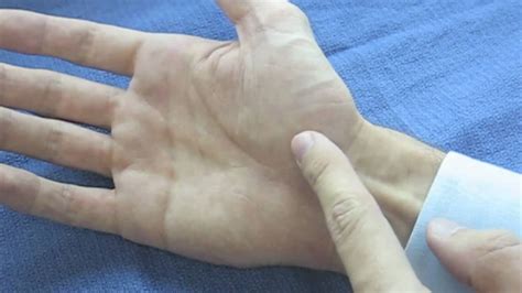 Hand Surface Anatomy Palm Side Youtube