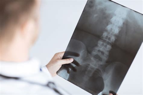 Is Your Spine Misaligned What To Know About Symptoms And Treatments