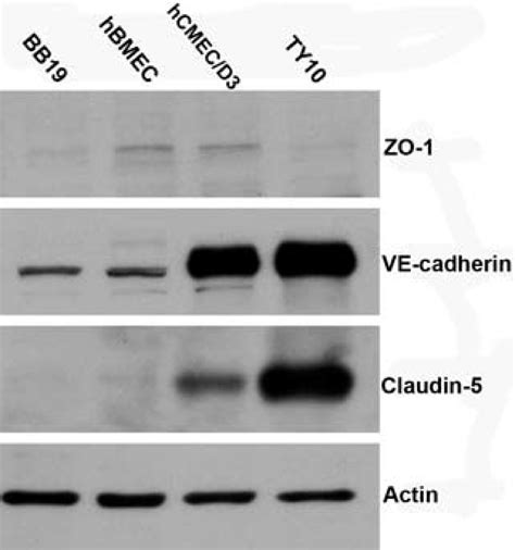 Western Blot Analysis Of Tight Junction Proteins ZO 1 Claudin 5 And