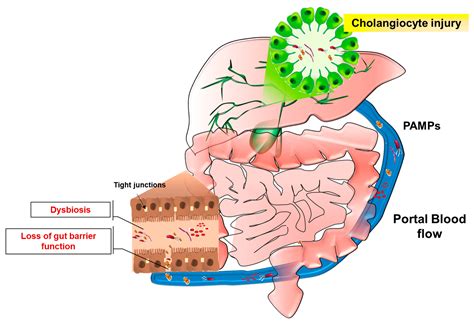 Ijms Free Full Text Inflammation And The Gut Liver Axis In The