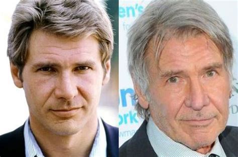 Harrison Ford Before And After Plastic Surgery 3 Celebrity Plastic Surgery Online