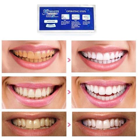 Teeth Treat 3d Teeth Whitening Strips Instructions