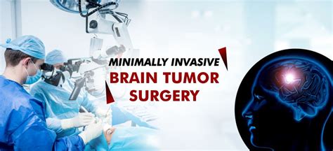 Minimally Invasive Brain Tumor Surgery Amandeep Hospital