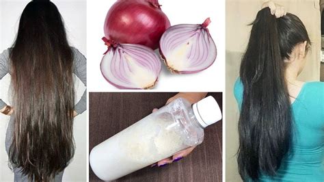 Onions Will Make Your Hair Grow Faster Youtube