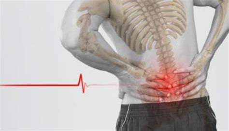 Sacroiliac Joint Dysfunction And How Your Chiropractor Can Help Back And Neck Center Of NJ