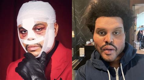 He doesn't want to be her friend and… The Weeknd reaparece y asusta a sus fans con su nuevo ...