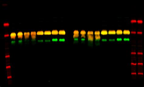 What Causes Smears In Western Blot Like These