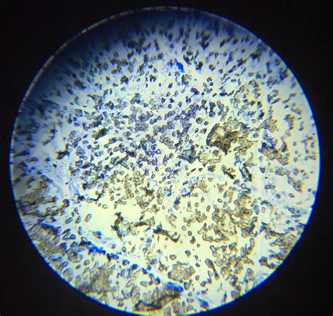 You know, animal cell structure contains only 11 parts out of the 13 parts you saw in the plant cell diagram, because chloroplast and cell wall are available only in a plant cell. A school of fish: Plant and Animal Cells through the ...