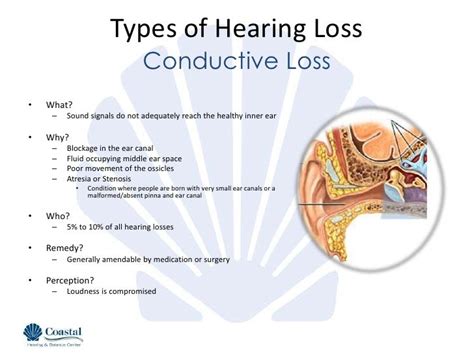 Types Of Hearing Loss
