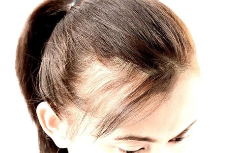 Natural Hair Extensions Signs Of New Hair Growth On Scalp