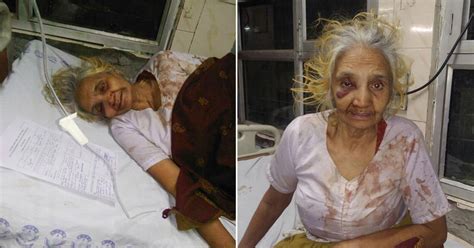 Horrific Images Show A 70 Year Old Woman Brutally Beaten By Her Son