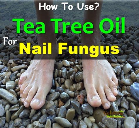 How To Get Rid Of Nail Fungus With Tea Tree Oil Nail Fungus Nail Oil