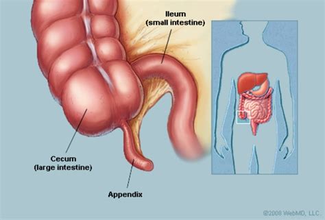 Anatomy presentation by shaells joshi 18054 views. Appendix (Anatomy): Appendix Picture, Location, Definition ...