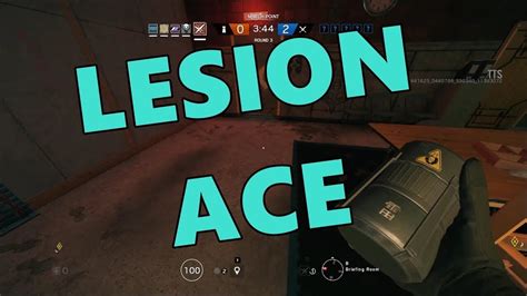 My First Ace With Lesion Youtube