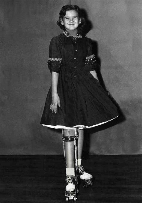 Pin By Dianne Dych On Polio 3 Modern Outfits Fashion Leg Braces