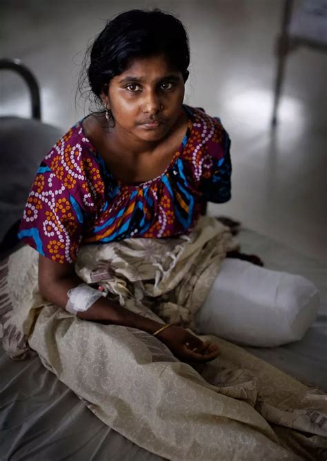 Survivors Of Bangladesh S Factory Collapse Who Had Limbs Amputated