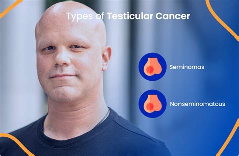 Testicular Cancer Everything You Need To Know Actc