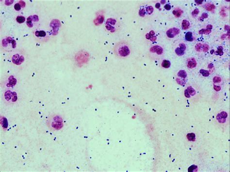 Streptococcus Pneumoniae Gram Positive Diplococci On The Initial