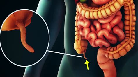 Scientists Have Finally Discover The Function Of The Human Appendix