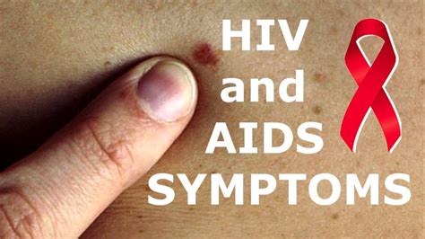 Symptoms And Stages Of Hiv Za