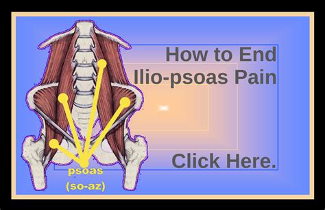 Psoas Muscle Referred Pain