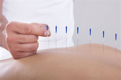 Is It Time To Give Acupuncture A Try For Pain Relief Harvard Health