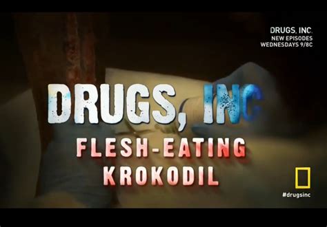 Abraxas 365 Dokumentarci Drugs Inc Flesh Eating Krokodil 2014