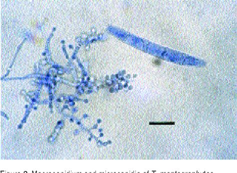 Figure 1 From Dermatophytes In Domestic Animals Semantic Scholar