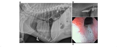 Hiatal Herniation Gastroesophageal Reflux And Esophagitis In A