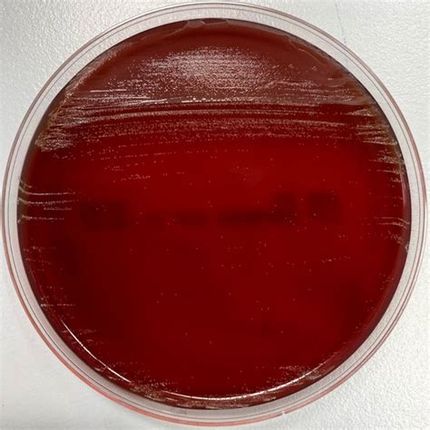 Culture Colonies Observed On Brucella Hk Agar After 48 H Of Incubation