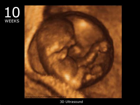 10 Week 3d Ultrasound Baby Picture Pregnancy Symptoms Week By Week