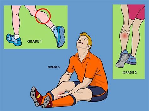 How To Treat A Torn Calf Muscle 14 Steps With Pictures Torn Calf