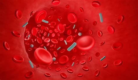 Sepsis Blood Poisoning And Septic Shock Symptoms Causes And