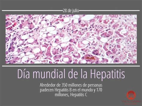 Hepatitis C Qué es Cómo se Contagia Salud