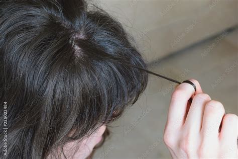 Trichotillomania Human Impulse Behavioral Problem Hair Pulling