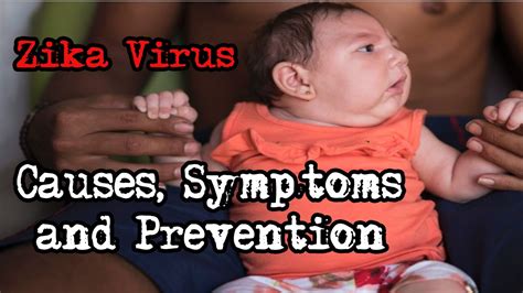 Zika Virus Zika Virus Causes Symptoms And Prevention Youtube