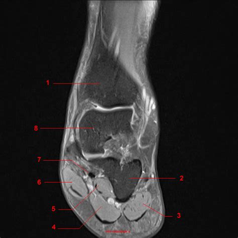 Top suggestions for foot muscle anatomy mri. MRT der Fußgelenk: T2-gewichteten FATSAT koronaren Schnitte