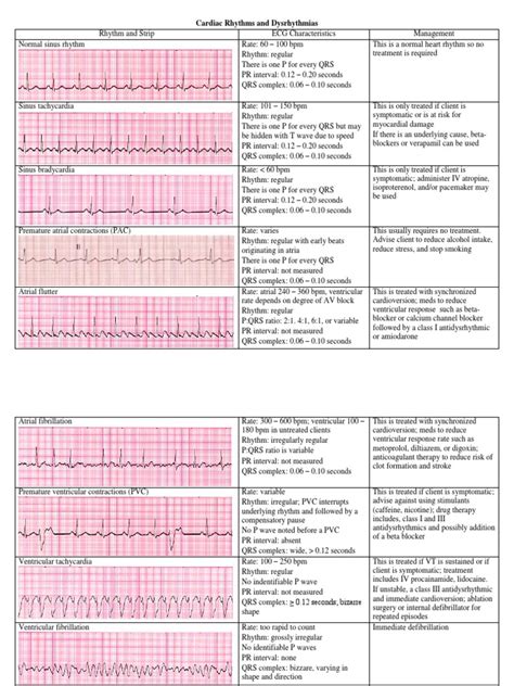 Cardiac Dysrhythmias Cardiac Arrhythmia Electrocardiography