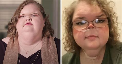 Fans Praise ‘1000 Lb Sisters Star Tammy Slaton For Her ‘amazing Weight Loss Journey