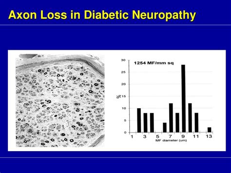 Ppt Duloxetine In The Treatment Of Diabetic Peripheral Neuropathic