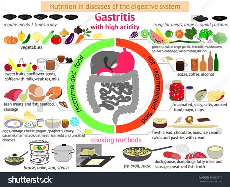 Infographics Proper Nutrition Diseases Digestive System 库存矢量图（免版税