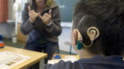 Cochlear Implants Redefine What It Means To Be Deaf Npr