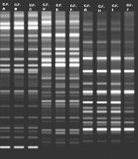 Randomly Amplified Polymorphic Dna Polymerase Chain Reaction Banding