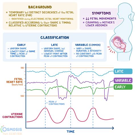 Fetal Heart Rate Tracing Meaning Best Games Walkthrough