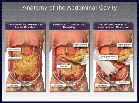 illustration of the abdominal cavity trial exhibits inc