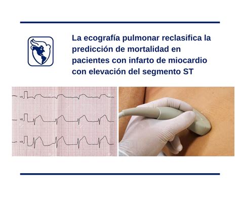 La ecografía pulmonar reclasifica la predicción de mortalidad en pacientes con infarto de